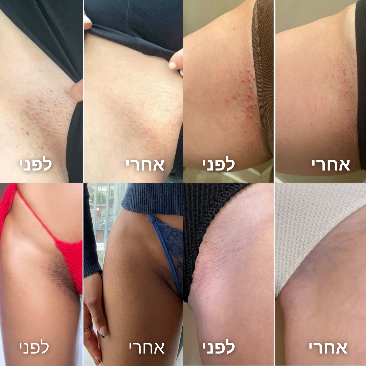 מסיר השיער של - ™Alora