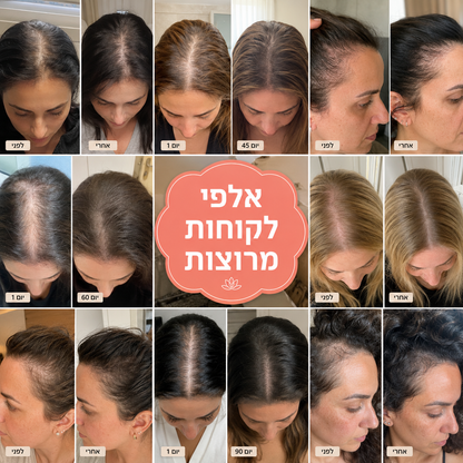 סרום קומפלקס להפחתת נשירה וצמיחה מחודשת