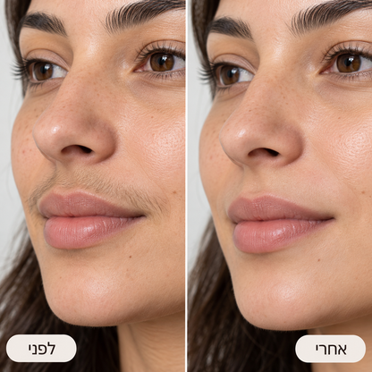 מכשיר דרמפלנינג קולי להסרת שיער הפנים של ALORA™
