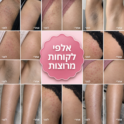 סכין גילוח למניעת גירוי, פצעים ושיער חודרני של ALORA™