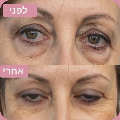 מדבקות היידרוג'ל קולגן לעיניים